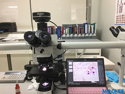 明美科研級攝像頭助力香港大學(xué)深圳醫(yī)院血液科骨髓切片觀察