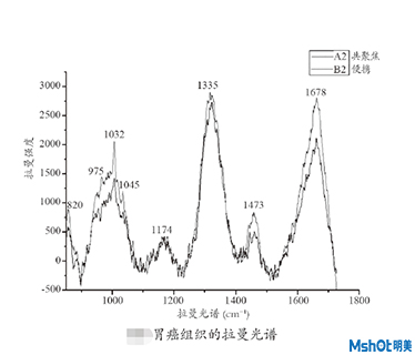 拉曼光譜技術(shù)在生物醫(yī)學(xué)中的應(yīng)用
