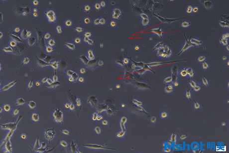 倒置顯微鏡下的細(xì)胞培養(yǎng)