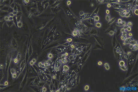 明美倒置顯微鏡助力生物制藥觀察活體細(xì)胞