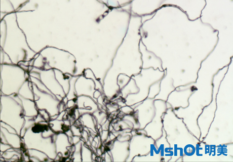 顯微鏡相機(jī)下的艾絨